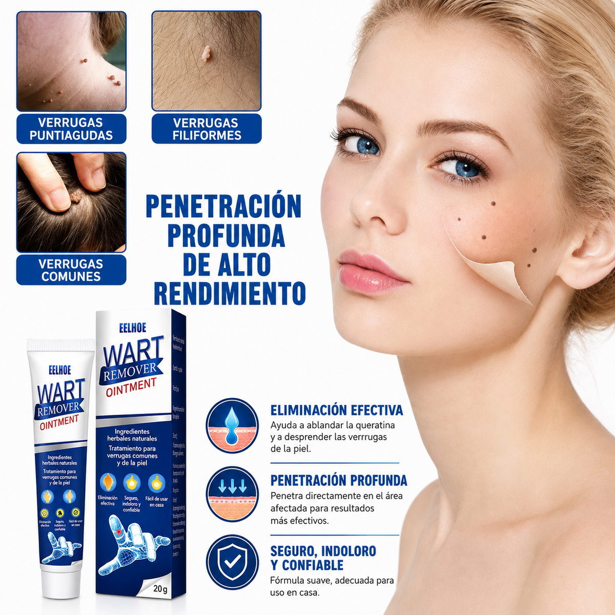 Removedor de Verrugas 30 ml | Aplicación Precisa
