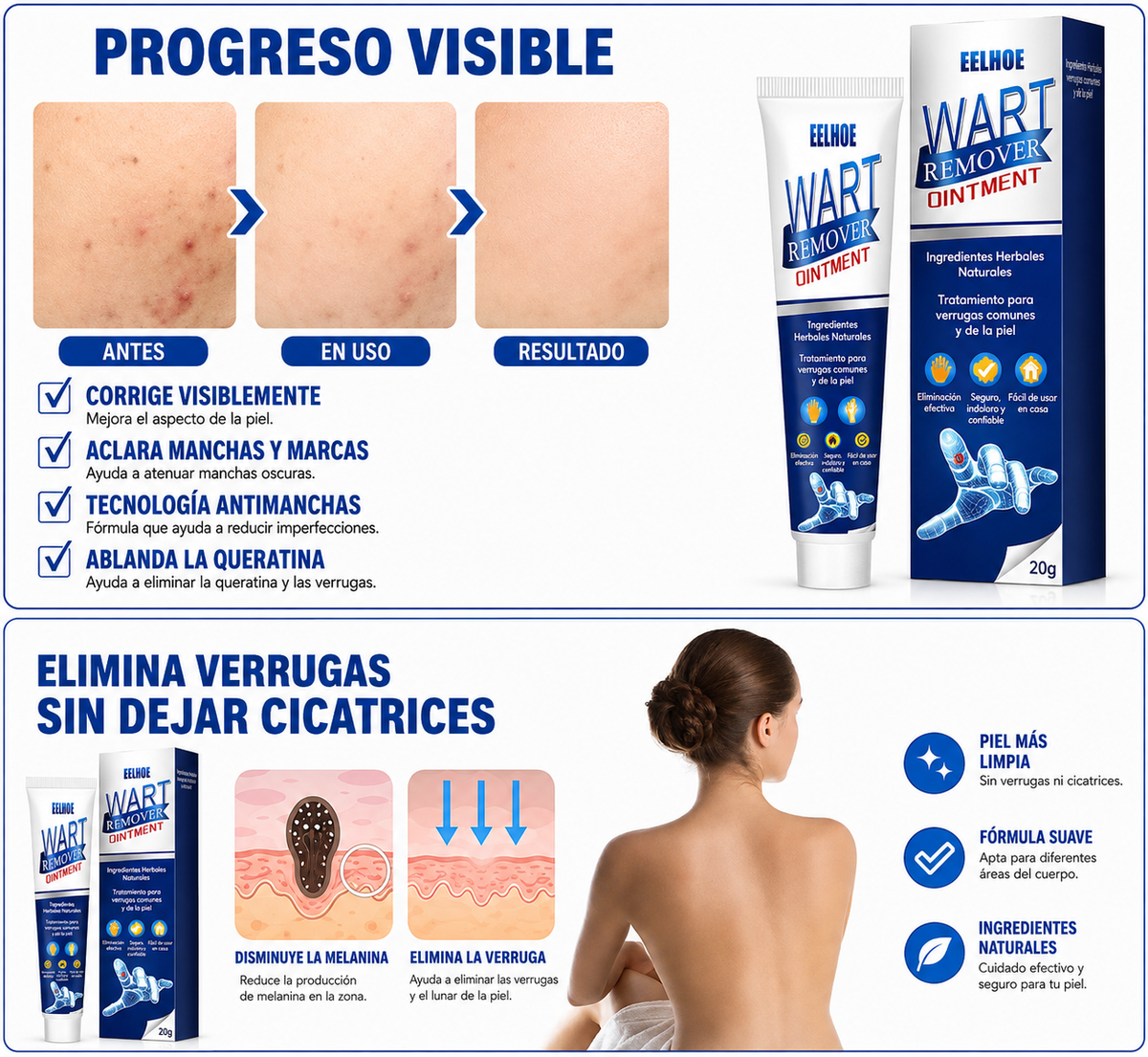 Removedor de Verrugas 30 ml | Aplicación Precisa