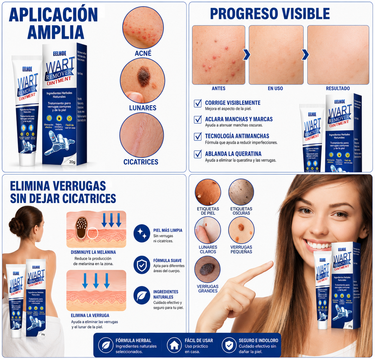 Removedor de Verrugas 30 ml | Aplicación Precisa